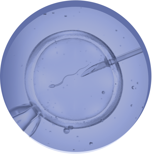 Illustrazione di un ovocita in fase di iniezione con uno spermatozoo, utilizzata per rappresentare l'area specialistica "IVF" di Eurofins Genoma, specializzata nella Procreazione Medicalmente Assistita (PMA) e nelle analisi genetiche reimpianto.