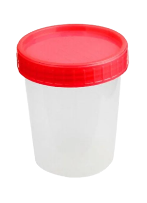 Contenitore sterile con tappo rosso utilizzato per la raccolta del campione di urine nella ricerca an/ap di Eurofins Genoma.