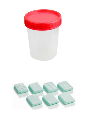 Contenitore sterile con coperchio rosso e blocchetti di paraffina per la raccolta e conservazione di campioni di biopsie/tessuti nel test di Eurofins Genoma.