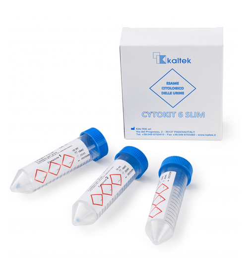 Kit CYTOKIT 6 SLIM con conservante utilizzato per la raccolta e conservazione del campione di urina nel test di citologia urinaria su 3 campioni di Eurofins Genoma.