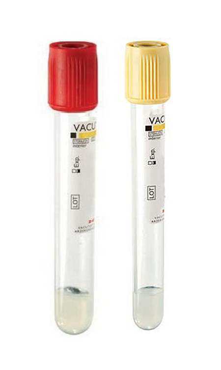 Provette con tappo rosso (gel + clot activator) e tappo giallo utilizzate per la raccolta del siero nel BI-TEST di Eurofins Genoma.